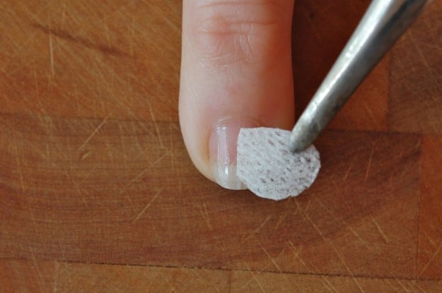 Fingernail Lifting From Nail Bed - Doctor insights on ...