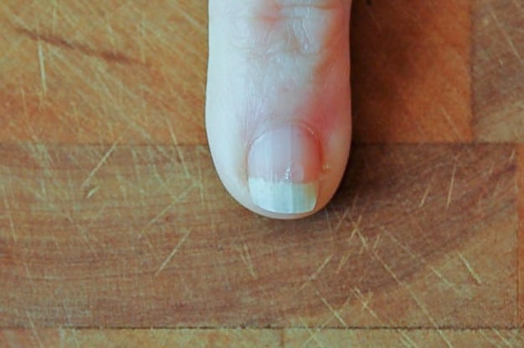 Drop of superglue on nail.
