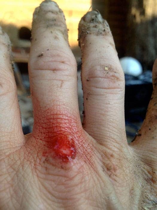 bleeding-knuckles