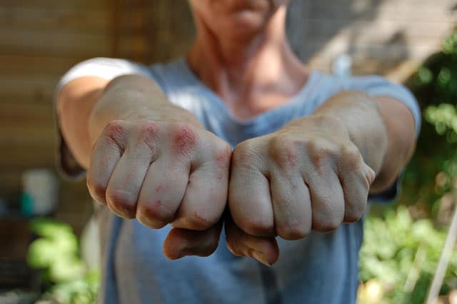 cob-oven-bleeding-knuckles