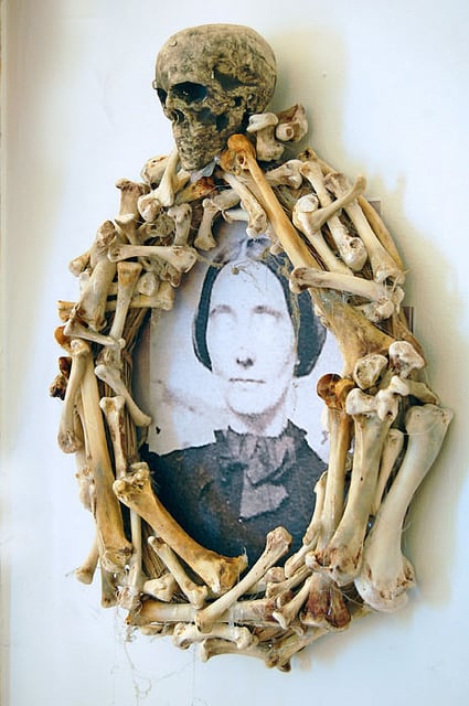 Bone Frame