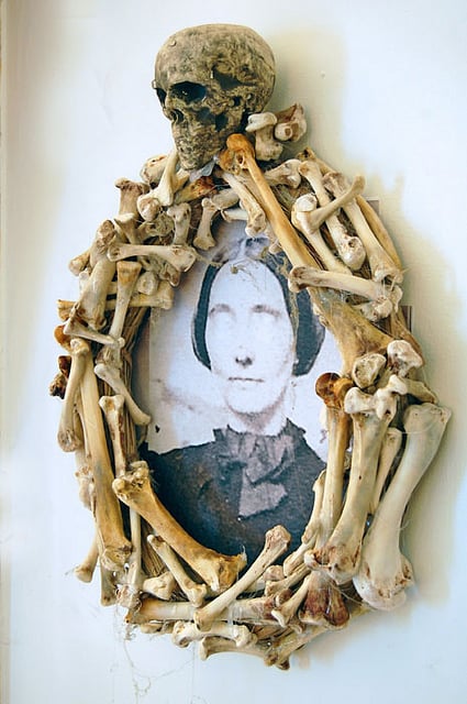 Bone Frame