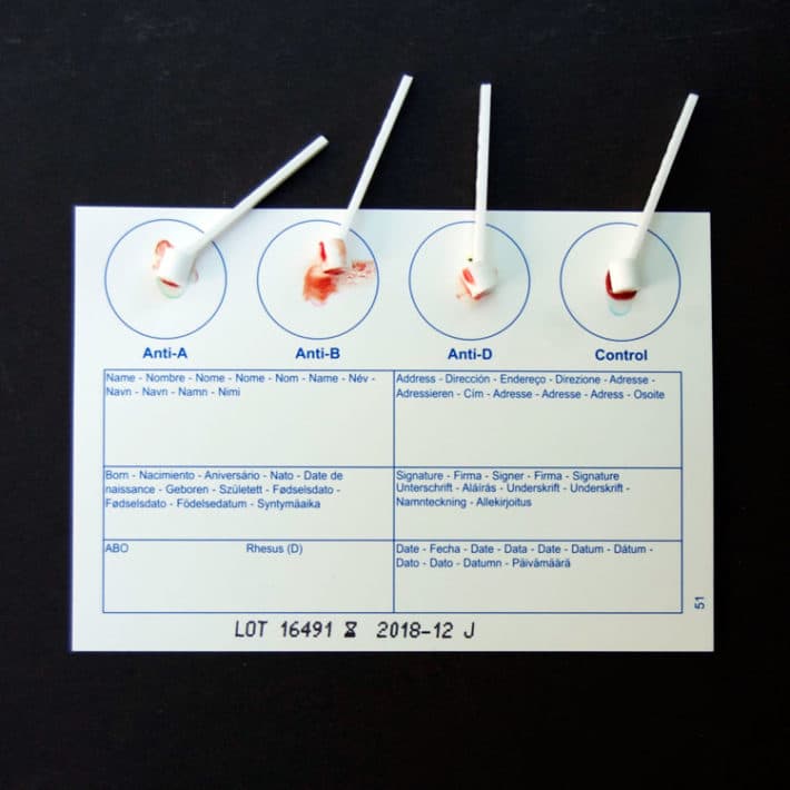 Blood smears on at home Eldoncard, blood typing kit.