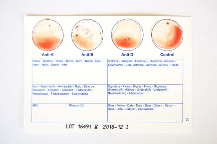 Test results on at home blood group test card showing B-.