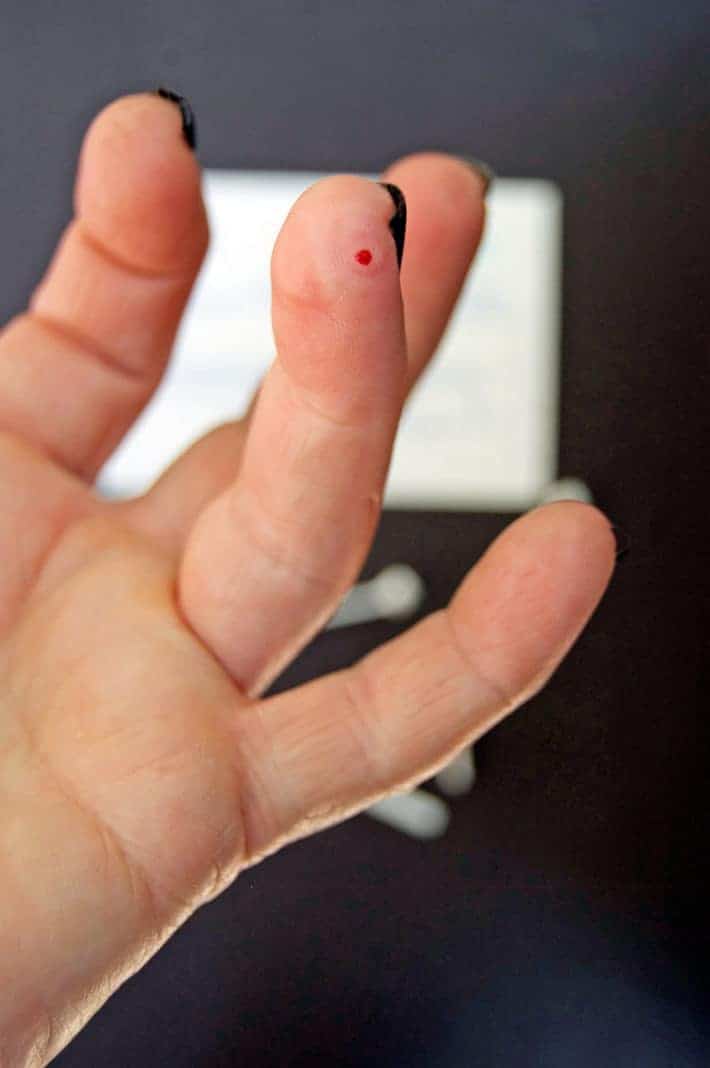 Small drop of blood on tip of ring finger after using a lancet.