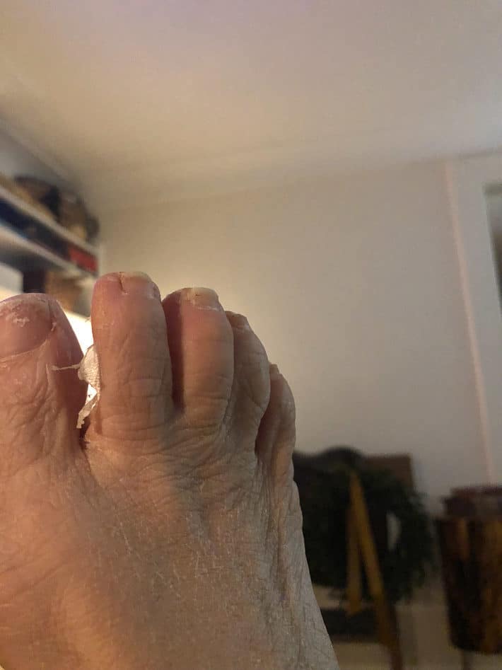 How All The Skin Peeled Off Of My Feet Home Pedicure Review The Art Of Doing Stuff