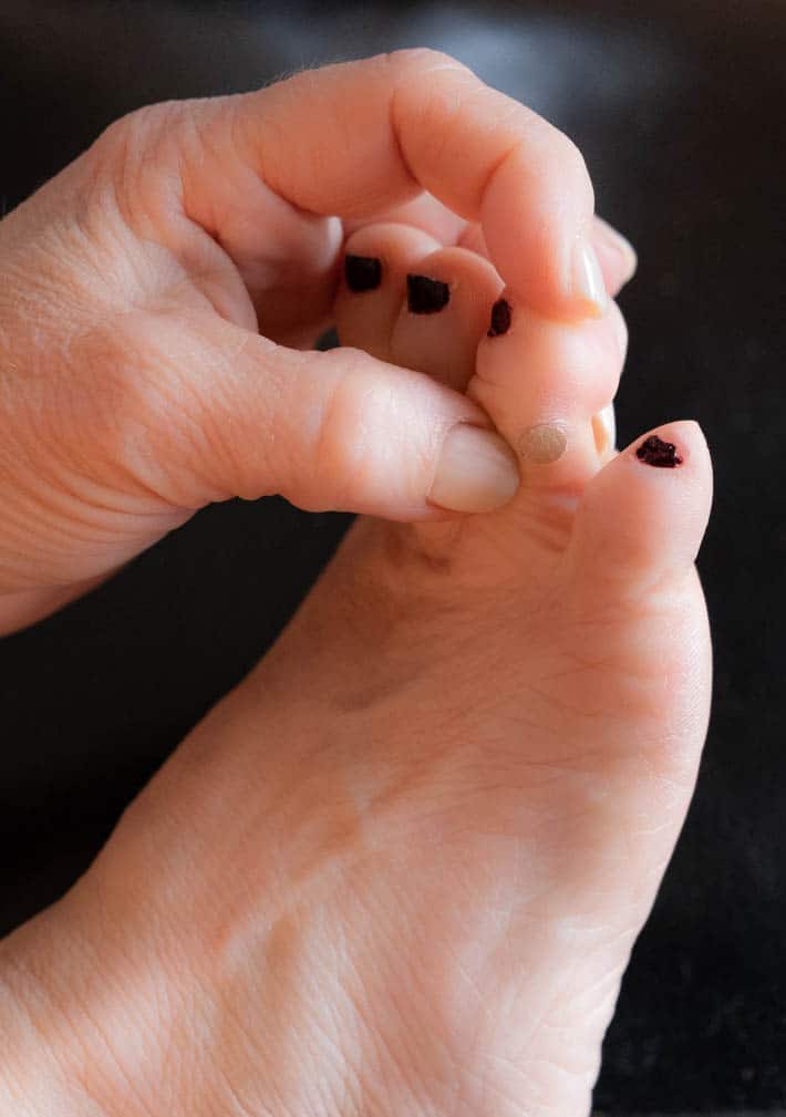 Salicylic Acid Plantar Wart Removal Ses Bios Pics salicylic-acid-plantar-wart-removal-ses-bios-pics
