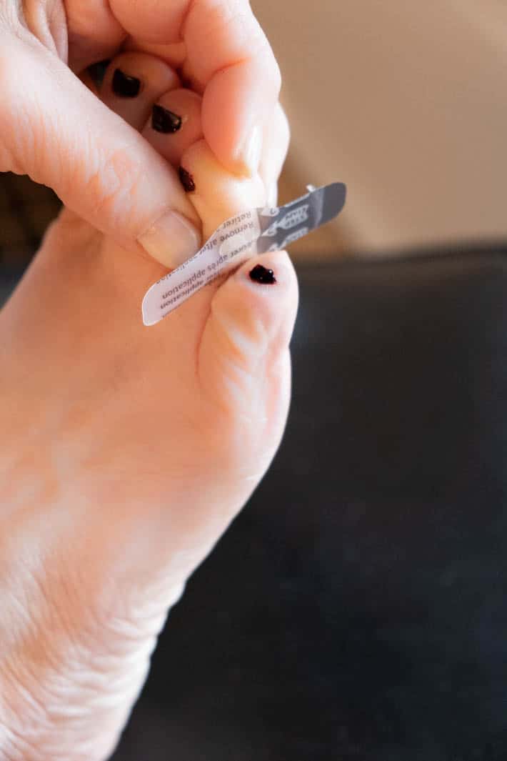 The clear wart bandaid being applied in between toes to secure the pad.