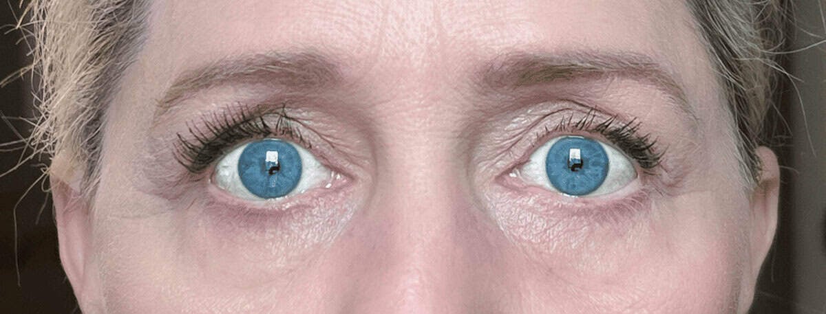 Terez & Honor eyelash serum results.